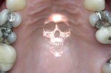 The dentistry holocaust: How America has been mercury poisoned by an industry in denial The dentistry holocaust: How America has been mercury poisoned by an industry in denial