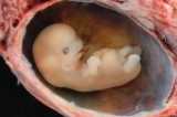 150 human animal hybrids grown in UK labs: Embryos have been produced secretively for the past three years 150 human animal hybrids grown in UK labs: Embryos have been produced secretively for the past three years